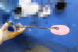 Bé gái 12 tuổi nhập viện vì nhét xà phòng vào vùng kín, cảnh báo nguy hiểm