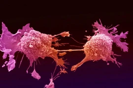 Vắc-xin LungVax hy vọng mới trong phòng ngừa ung thư phổi