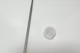 Bé trai gần 4 tuổi bị nghẹt mũi, sốt cao do 'nắp lọ thuốc' nằm trong mũi