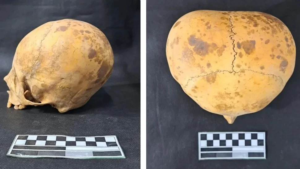 Sửng sốt hộp sọ người lạ 700 năm tuổi ở Argentina