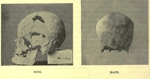 Căn bệnh "lạ" khiến pharaoh Ai Cập thành người khổng lồ