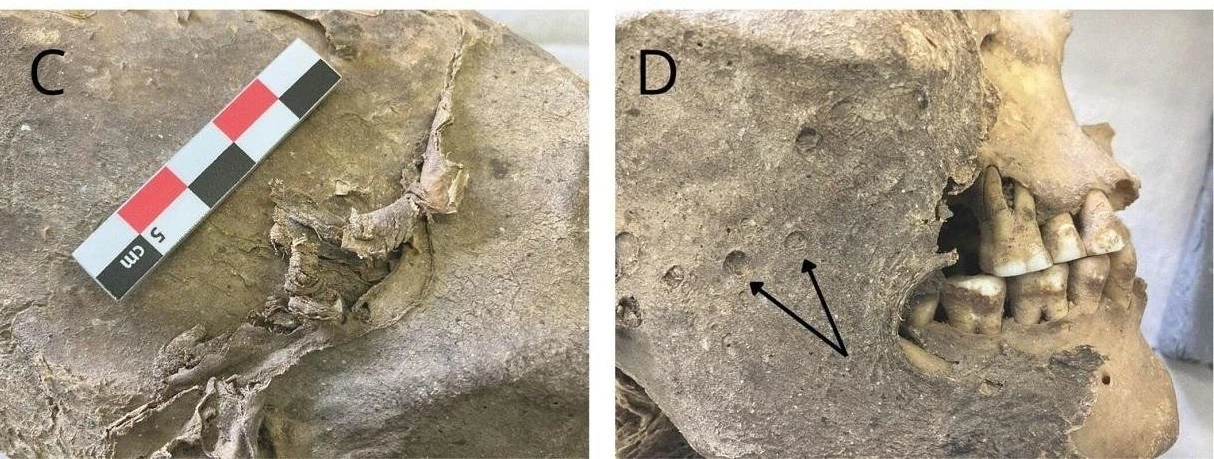 Tìm ra danh tính xác ướp chỉ có phần đầu sau hơn 100 năm