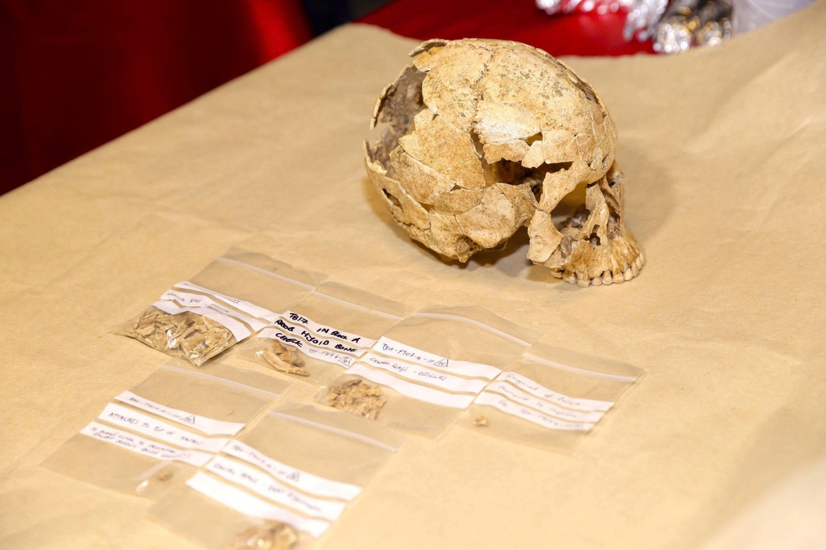 Nguyên nhân tử vong người đàn ông được xác định có chấn thương ở phần xương sườn bởi một công cụ có đầu nhọn làm bằng đá thạch anh đâm vào sau đó gây nhiễm trùng. Ảnh: Vietnamnet.