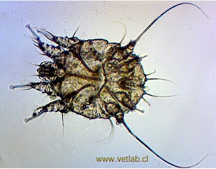  Thủ phạm gây bệnh ghẻ quen thuộc. Loài này chính là tác nhân gây ra bệnh ghẻ, một tình trạng da liễu phổ biến trên toàn thế giới. Triệu chứng điển hình là ngứa nhiều vào ban đêm, kèm theo các nốt đỏ hoặc mụn nước nhỏ. Ảnh: Pinterest.