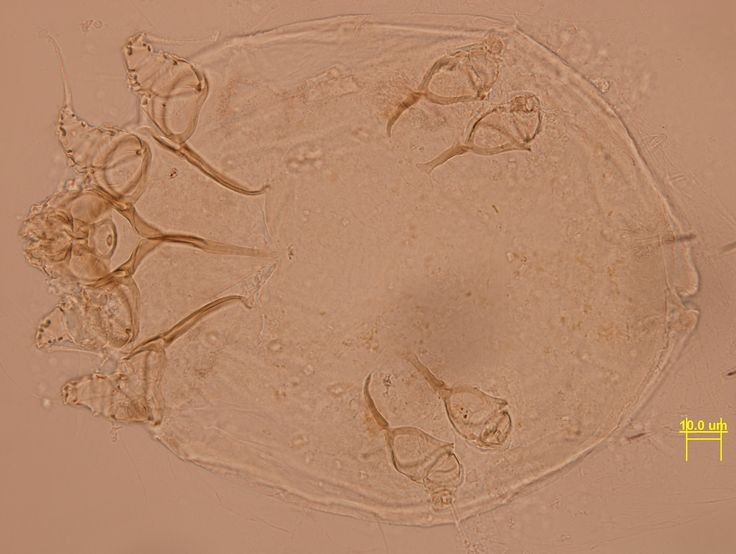  Lây lan nhanh qua tiếp xúc gần. Bệnh ghẻ dễ lây qua tiếp xúc da kề da, đặc biệt trong môi trường đông người như ký túc xá, gia đình hoặc cơ sở chăm sóc. Việc dùng chung quần áo, chăn màn cũng có thể làm lây nhiễm. Ảnh: Pinterest.