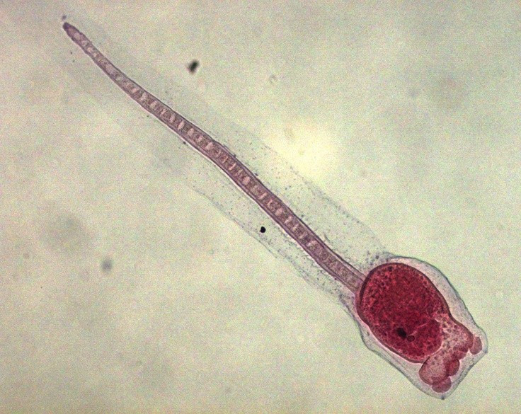  Không phải “động vật đơn giản” như vẻ ngoài. Dù trông giống những túi mềm vô tri, các loài động vật có bao (phân ngành Tunicata) thực chất có cấu trúc sinh học phức tạp, đặc biệt ở giai đoạn ấu trùng, khi chúng sở hữu dây sống – đặc điểm then chốt của động vật có xương sống. Ảnh: Pinterest.