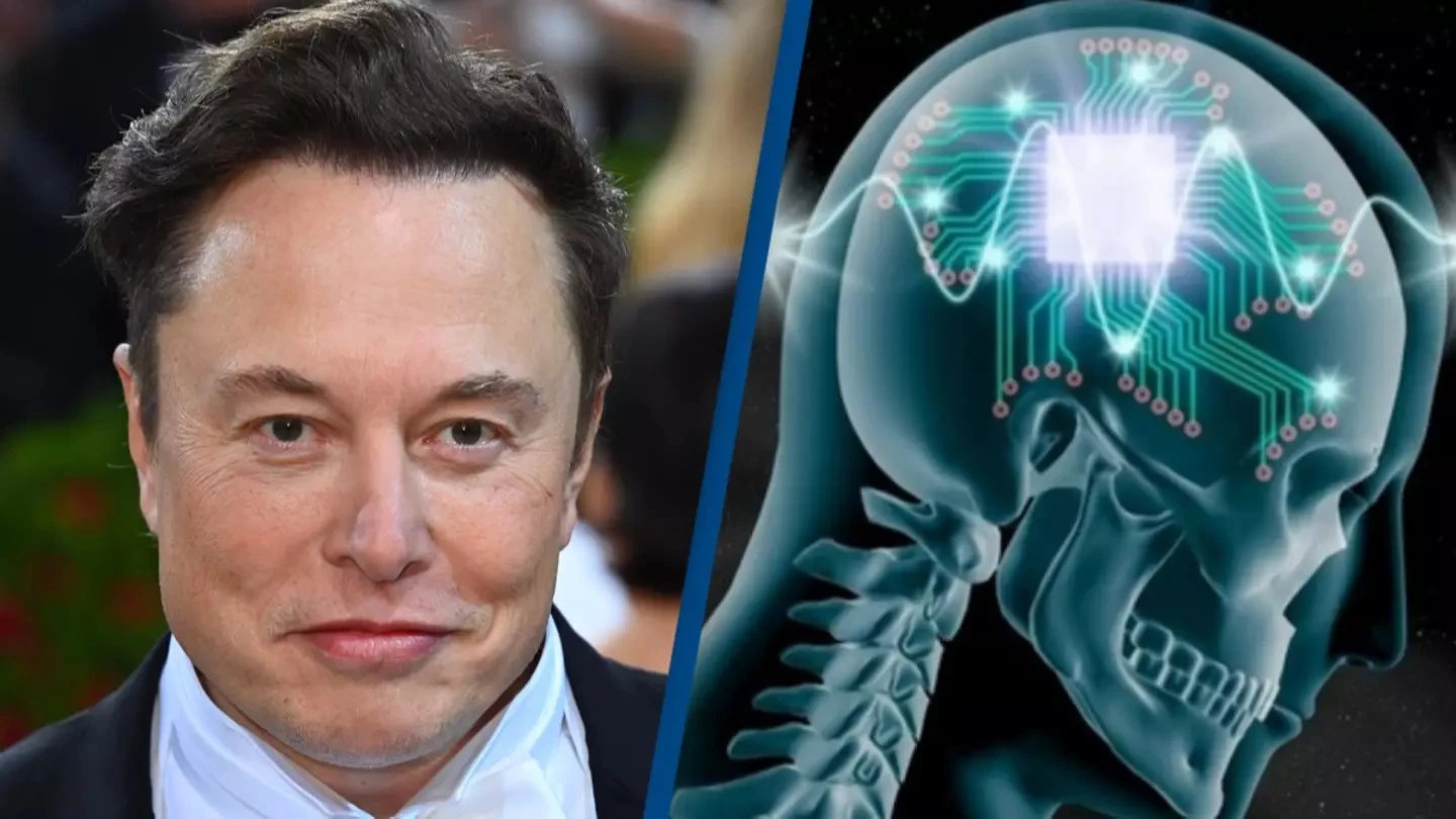 Neuralink của Elon Musk lập kỷ lục cấy chip não 1,5 giây