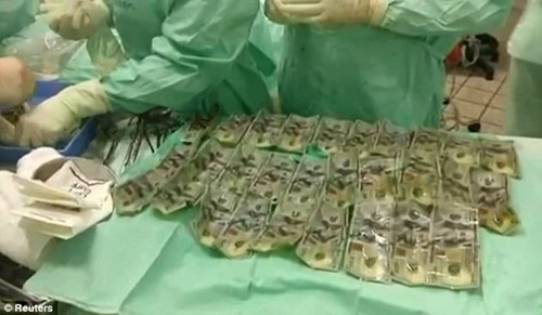 Lộn ruột vì chồng ngoại tình, cô Sandra Milena Almeida, ở Colombia đã nuốt gọn số tiền tiết kiệm của hai vợ chồng vào bụng. Câu chuyện cụ thể>>> Điên tiết nuốt sạch tiền tiết kiệm vì chồng ngoại tình