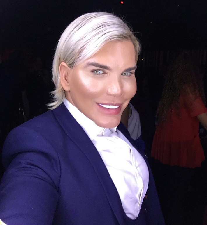 1. Rodrigo Alves: Rodrigo Alves (33 tuổi) luôn thất vọng về nhan sắc tự nhiên của mình. Vì thế, anh ta dùng hết số tiền được thừa kế từ ông nội để làm phẫu thuật chỉnh toàn gương mặt, tự biến mình thành búp bê Ken ngoài đời thực. Tổng số tiền mà chàng trai 33 tuổi dành cho những ca chỉnh sửa nhan sắc đến nay đã lên tới 400 nghìn bảng Anh. Dù mỗi lần lên bàn mổ đều vô cùng đau đớn, Alves cho biết sẽ tiếp tục sửa cho đến khi hài lòng.
