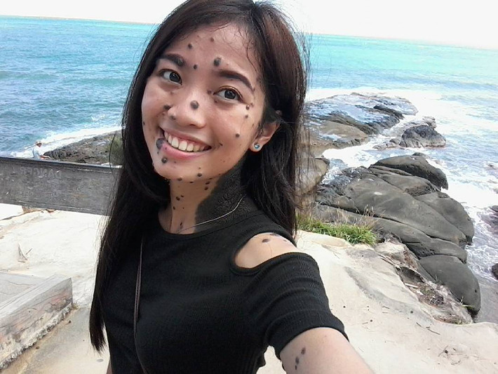 Hiện, Evita sở hữu tới hơn 44.000 người theo dõi trên trang Instagram cá nhân. Cô nàng hi vọng ước mơ giành giải cao trong các cuộc thi sắc đẹp của mình sẽ thành công, để tiếp thêm sức mạnh và nghị lực cho những người có hoàn cảnh giống mình, giúp họ biết cách chấp nhận bản thân và trở nên tự tin hơn, yêu đời, yêu cuộc sống hơn. (Nguồn Bored Panda)