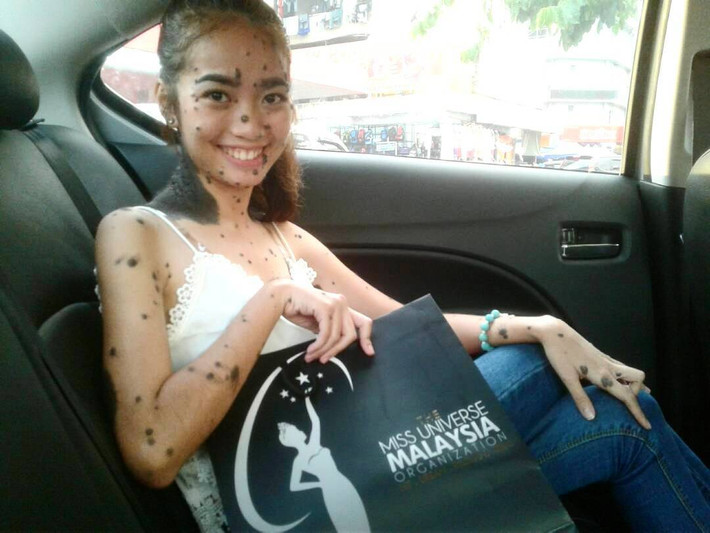 Hiện, Evita đang chờ đợi xem mình có lọt vào vòng tiếp theo của cuộc thi Hoa hậu Hoàn vũ Malaysia hay không. Nhưng ngay cả khi cô ấy không thành công, Evita nói rằng cuộc thi đã làm cho cô tự tin hơn và cô sẽ tiếp tục tham gia các cuộc thi sắc đẹp khác trong tương lai để chứng minh rằng tất cả mọi người đều đẹp theo cách riêng của mình. (Nguồn Bored Panda)
