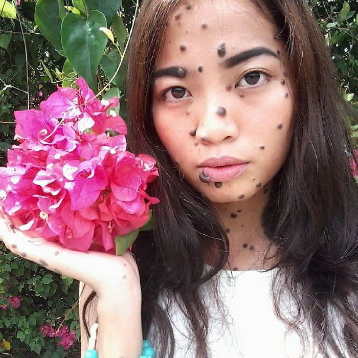 Chính vì những nốt ruồi mọc khắp cơ thể này mà Evita bị xa lánh, trêu chọc từ nhỏ. Cô là đối tượng bị bắt nạt thường xuyên ở trường học, bị gọi là cô gái quái vật. (Nguồn Bored Panda)