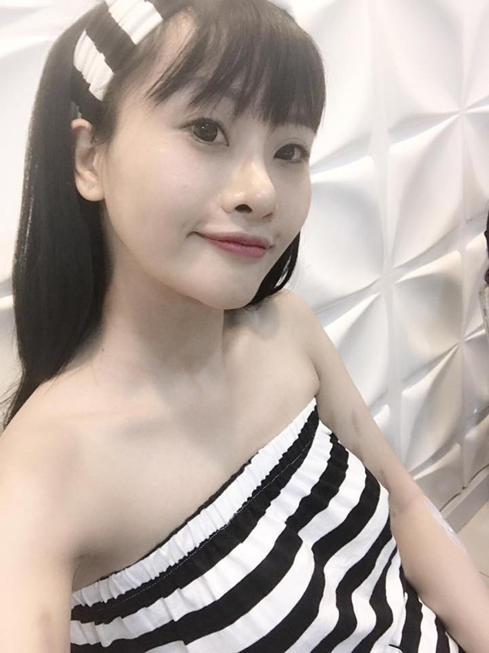 Tuy nhiên, nhiều dân mạng cũng tìm ra được bằng chứng rằng, nhan sắc của Chippy Pola đã được "qua tay dao kéo" của các bác sĩ phẫu thuật thẩm mỹ. Cũng chính cô nàng này thừa nhận rằng mình vừa trải qua cuộc phẫu thuật hạ xương gò má, theo mốt mặt tròn đang hot nhất hiện nay.