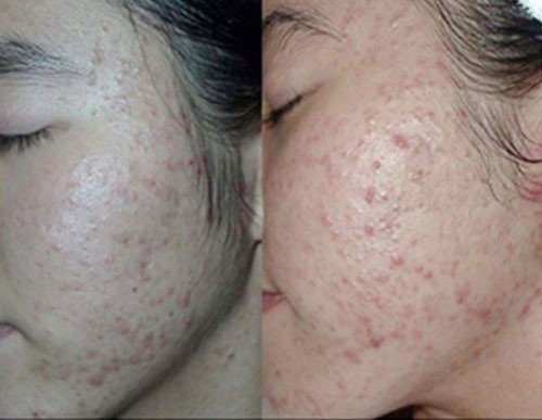 Đi kèm đó H.O cũng đăng tải câu hỏi: "Cả nhà cho em hỏi dùng sản phẩm bôi và bị như vậy giờ phải làm sao? Khách bôi theo hướng dẫn của nhà sản xuất". Ngay sau những bức ảnh của thành viên này, hội chị em đã một lần nữa lên tiếng cảnh tỉnh các thành viên của mình.