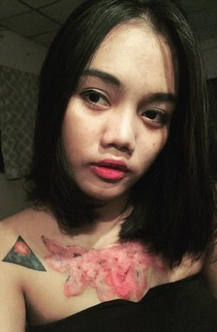 Nhìn cách xóa xăm của Pasuda khiến không ít người phải ớn lạnh và rùng rợn. Ảnh trong bài: Postthai.