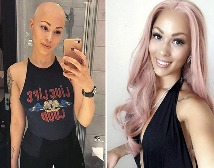 Hình ảnh trước và sau khi đội tóc giả của cựu y tá bệnh viện Malmo - Therese Hansson. Ảnh trong bài: Instagram nhân vật.