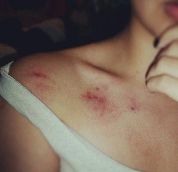 "Vùng cấm hôn", tuyệt đối đừng chạm vào khi "yêu" - Hình 2