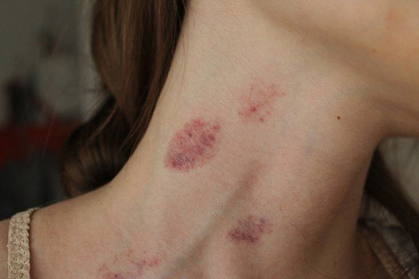 "Vùng cấm hôn", tuyệt đối đừng chạm vào khi "yêu"