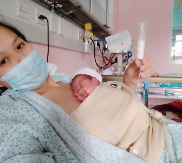 Hành trình sống sót kỳ diệu của bé sơ sinh nhẹ cân nhất Việt Nam - Hình 3 Hanh trinh song sot ky dieu cua be so sinh nhe can nhat Viet Nam-Hinh-3