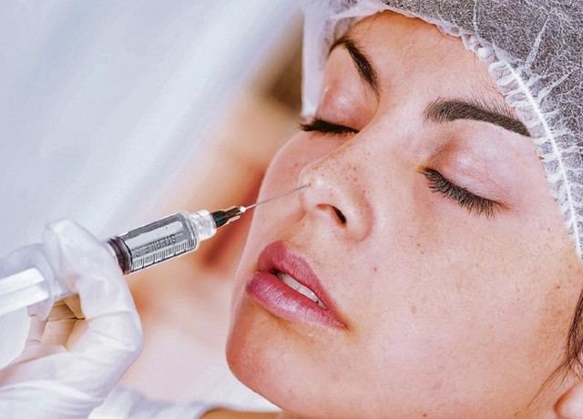 Nghẹt thở cuộc "chạy đua" cứu cô gái mù mắt sau tiêm filler - Hình 2 Nghet tho cuoc