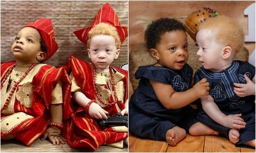 Chào đời cách vài phút, cặp song sinh khác nhau ngỡ ngàng