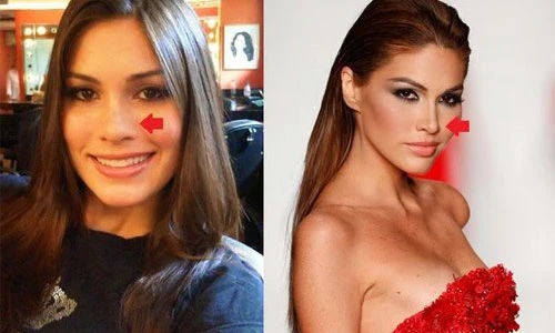 9 người đẹp “dao kéo” đăng quang Hoa hậu Hoàn vũ