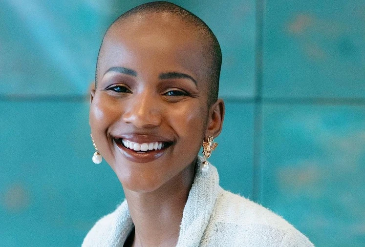 Nhan sắc cô gái đầu trọc lóc đăng quang Hoa hậu Nam Phi 2020