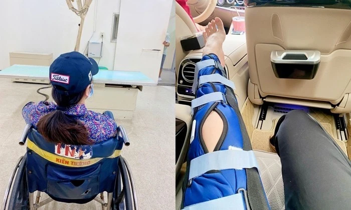 Nhật Kim Anh bị ngã rách dây chằng, nhìn nẹp chân mà xót