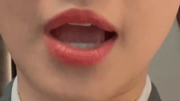 uy nhiên mới đây, cô nàng đã quay cận vào khuôn miệng để thấy rõ sự khác biệt. Có thể thấy chức năng nhai và hoạt động miệng không gặp quá nhiều vấn đề.