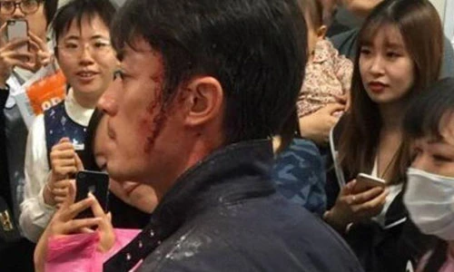 Bạn trai Lâm Tâm Như gây sốc với gương mặt đẫm máu