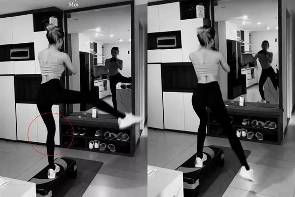 Thiều Bảo Trâm lộ đôi chân gầy như que củi