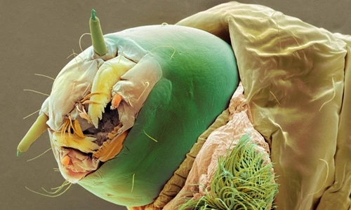 Chết khiếp những "quái vật" tý hon ẩn nấp quanh ta