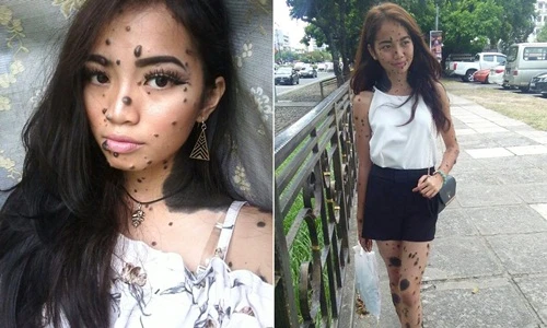 Chuyện lạ hôm nay: Cô gái "quái vật" và ước mơ ai cũng xót xa