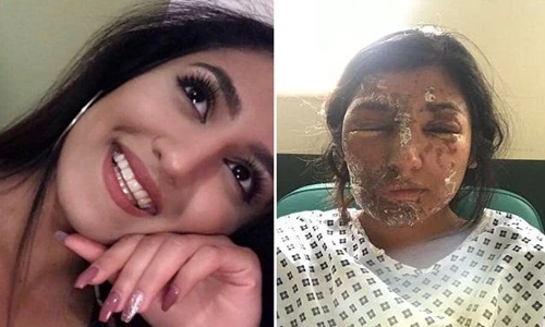 Cô gái xinh đẹp và tai họa kinh hoàng từ trên trời rơi xuống