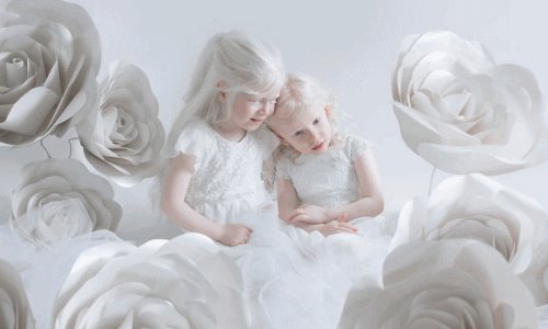 Từ những ảnh đắt giá này, ai cũng có cái nhìn khác với người bạch tạng