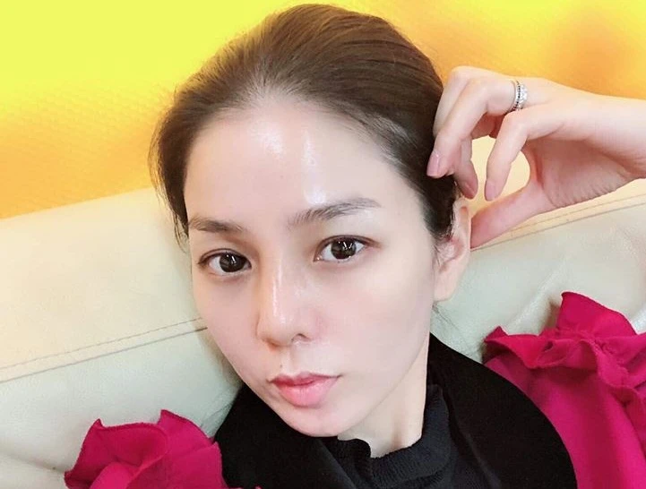 Bất ngờ nhan sắc Lệ Quyên khi tháo sụn mũi giả để tránh hoại tử