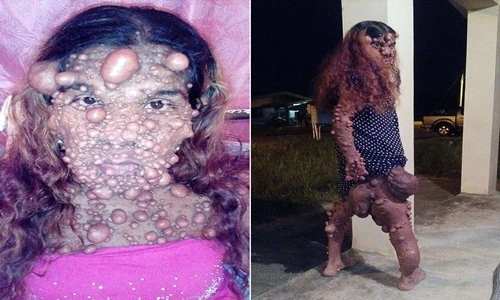 Chuyện lạ hôm nay: Người phụ nữ quái vật và nỗi đau phía sau 