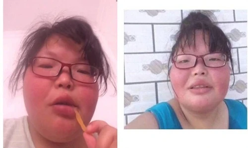 Chuyện lạ hôm nay: Gái cực xấu đạt giải hoa khôi sắc đẹp