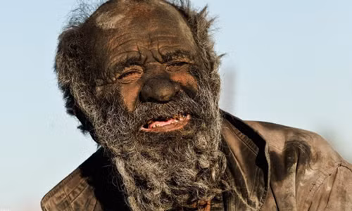 Phát hoảng với dị nhân 60 năm không tắm