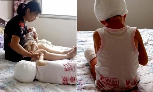 Chuyện lạ hôm nay: Mẹ đổ xăng đốt con và sự thật rợn người