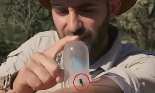 Điều gì xảy ra với cơ thể khi bị ong vò vẽ đốt?