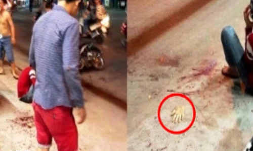 Clip: Thanh niên bị giang hồ chém đứt lìa tay ở Sài Gòn