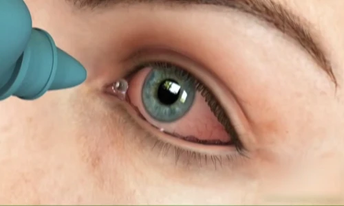 Cách sơ cứu khi trẻ bị vật nhọn đâm vào mắt