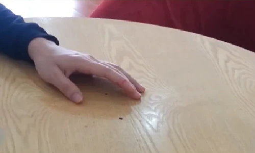 Cách chăm sóc vết đứt tay nhanh lành bạn cần biết