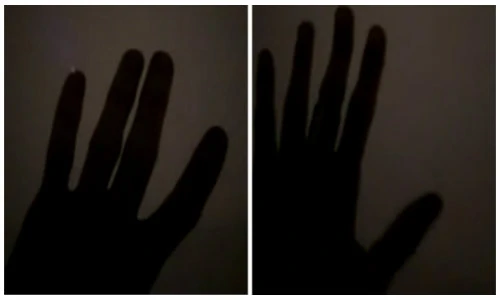 Kỳ lạ hiện tượng khiến ngón tay phát điện lóe ánh sáng