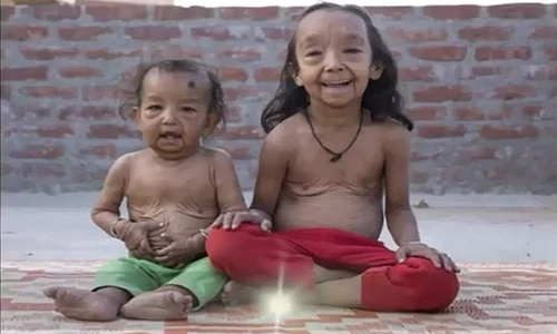 Kỳ lạ hai chị em 7 tuổi bị lão hóa thành... cụ già