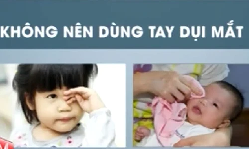 Phòng ngừa đau mắt đỏ đúng cách và hiệu quả thế nào?