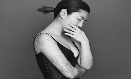 Ca sĩ Selina lần đầu lộ cơ thể đầy sẹo gây sốc