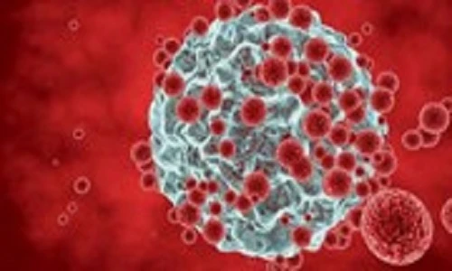 Phát hiện thêm 7 chất mới có thể gây ung thư