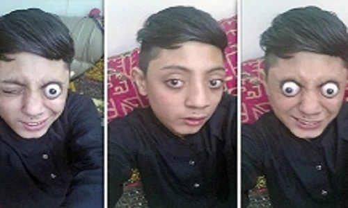 “Dị nhân” 14 tuổi có biệt tài... kéo mắt ra khỏi tròng